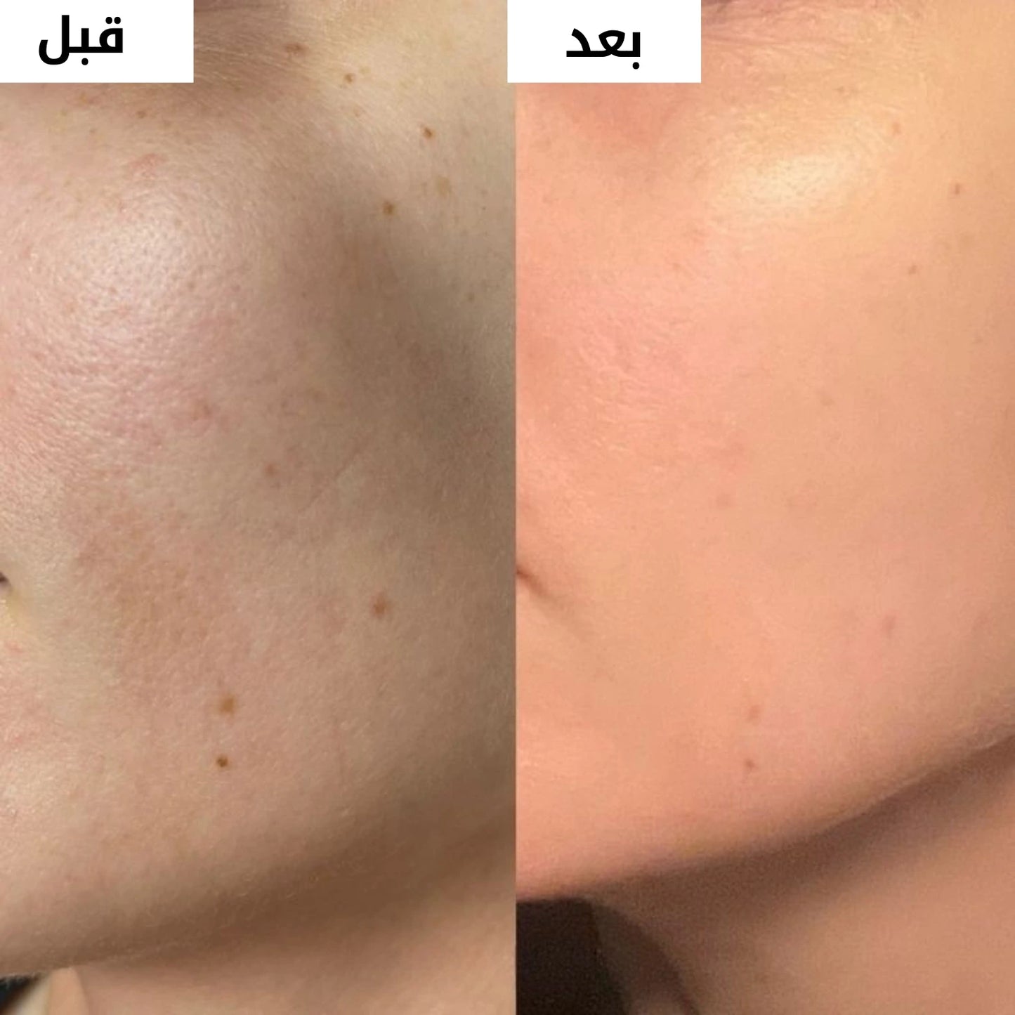 كريم التفتيح الكوري وتوحيد لون البشرة