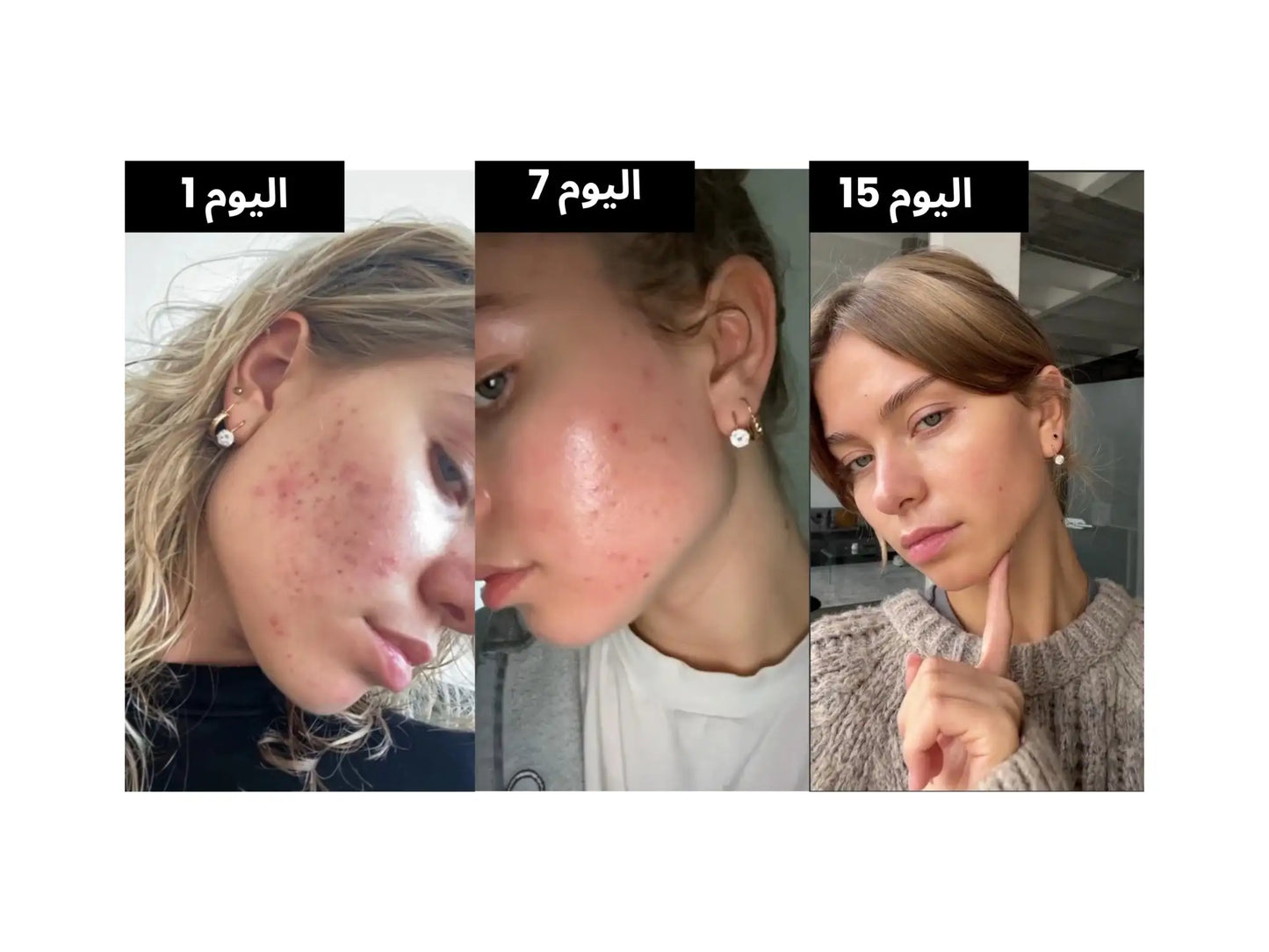 5 أنواع قوية من السيراميد تستهدف حاجز البشرة المدمر