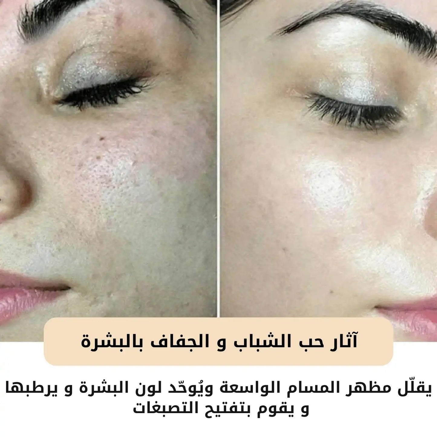 قناع البشرة السحري الليلي - بوتوكس طبيعي في عبوة لبشرة مشدودة وناعمة ومشرقة