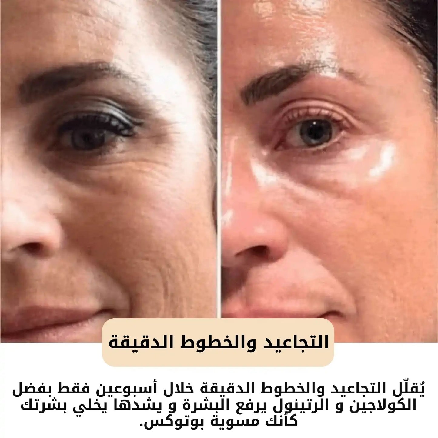 قناع البشرة السحري الليلي - بوتوكس طبيعي في عبوة لبشرة مشدودة وناعمة ومشرقة