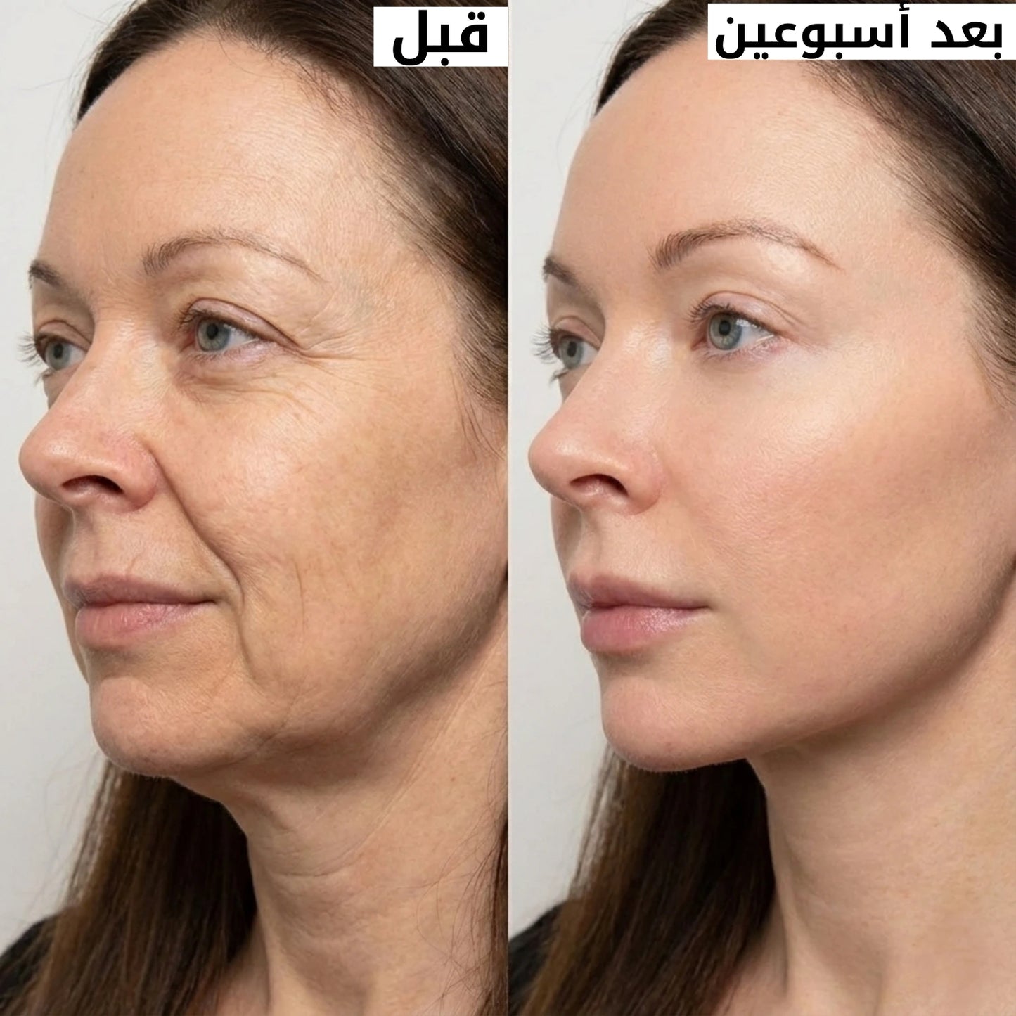 السيروم الكوري للرفع… البديل الذكي لحقن البوتوكس