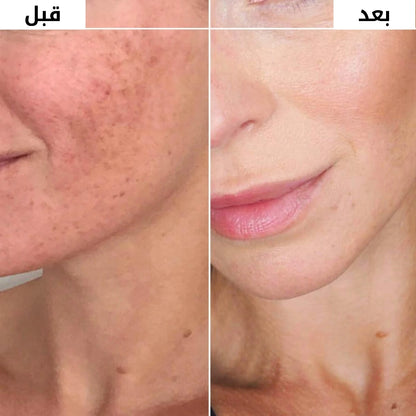 كريم التفتيح الكوري وتوحيد لون البشرة