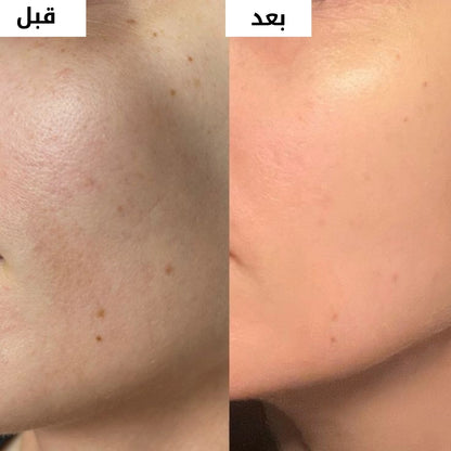 كريم التفتيح الكوري وتوحيد لون البشرة