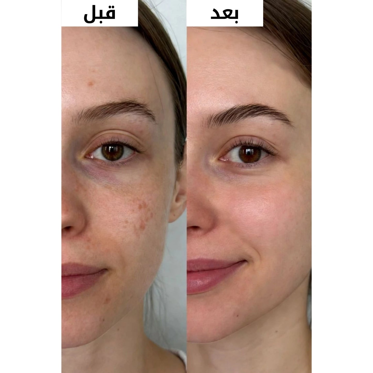 كريم التفتيح الكوري وتوحيد لون البشرة