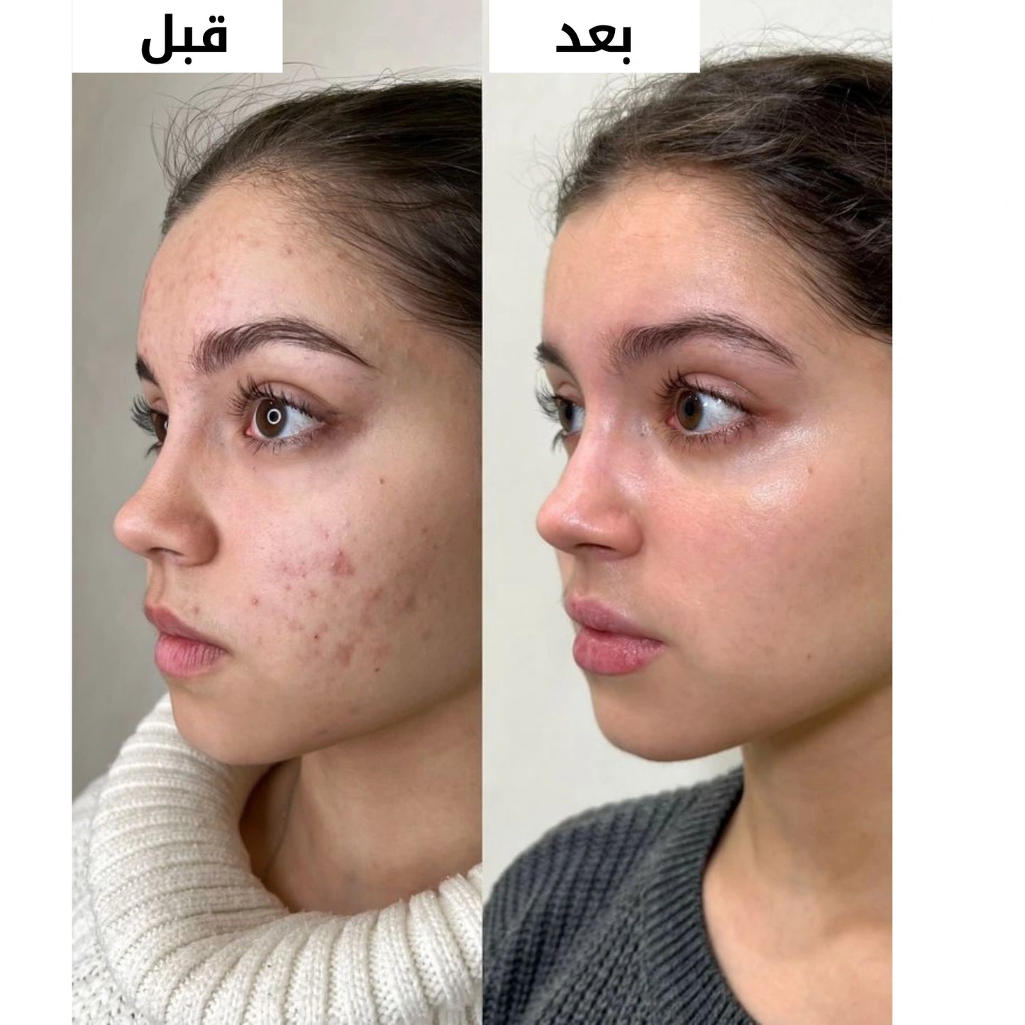 كريم التفتيح الكوري وتوحيد لون البشرة