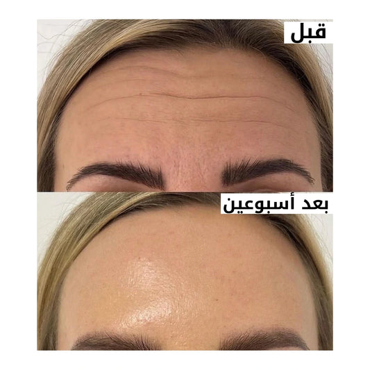 السيروم الكوري للرفع… البديل الذكي لحقن البوتوكس