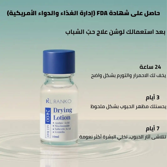 لوشن علاج حب الشباب بحمض الساليسيليك